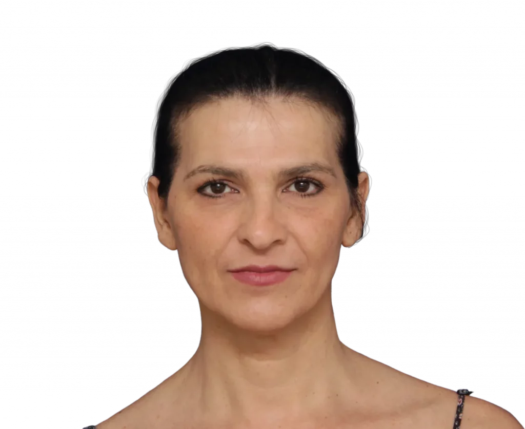 Frontal picture taken from Carmen before surgery