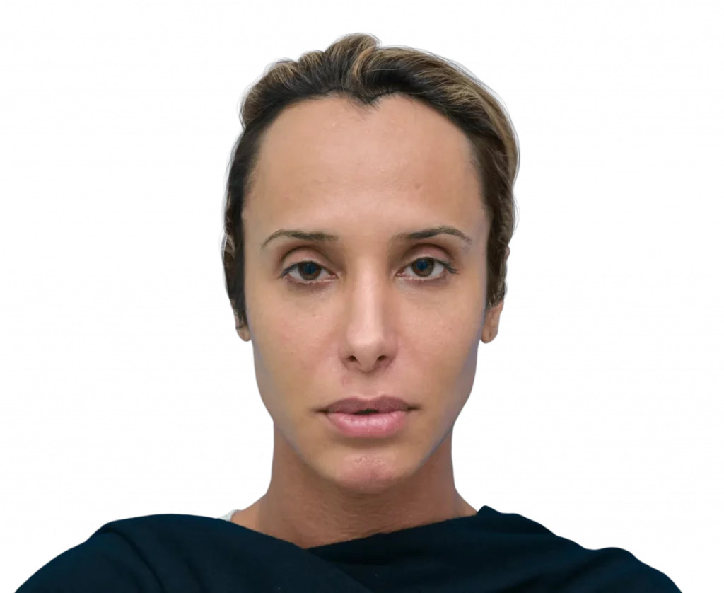 Frontal picture taken from Carol before surgery