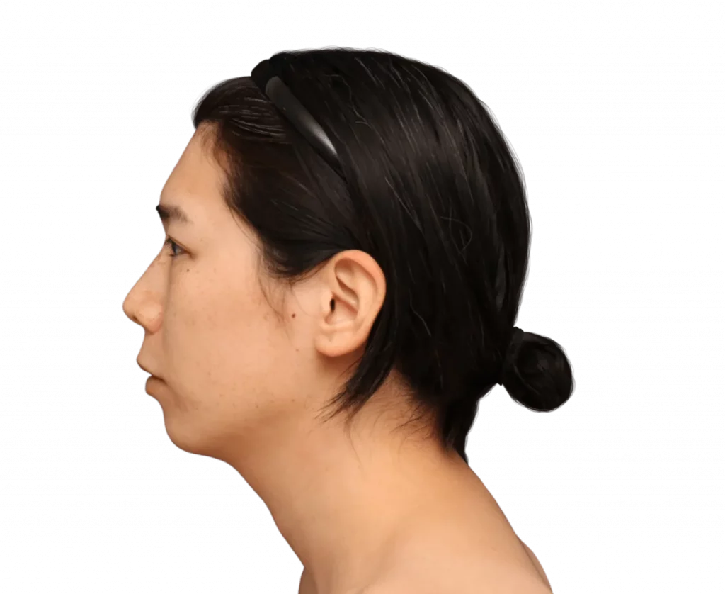 Picture taken from the left side of Harriet before surgery