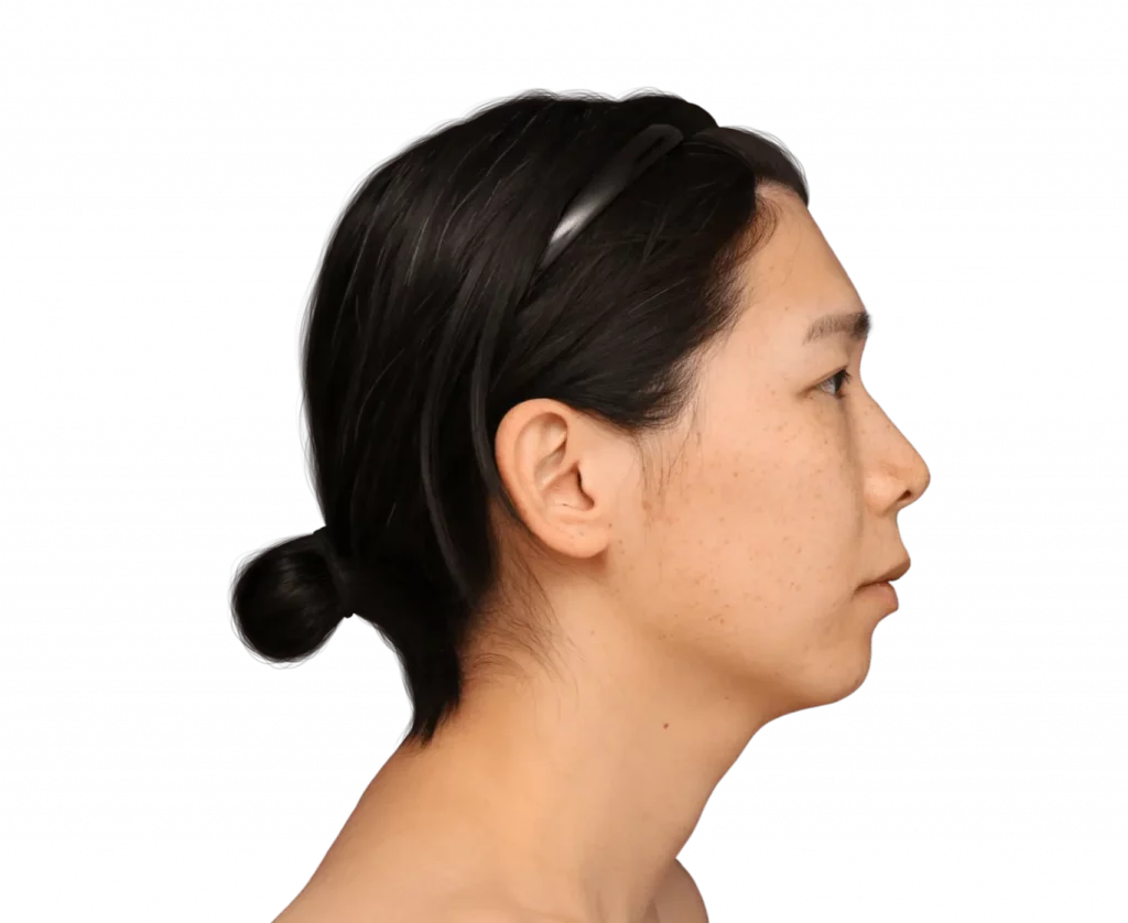 Picture taken from the side of Harriet before surgery