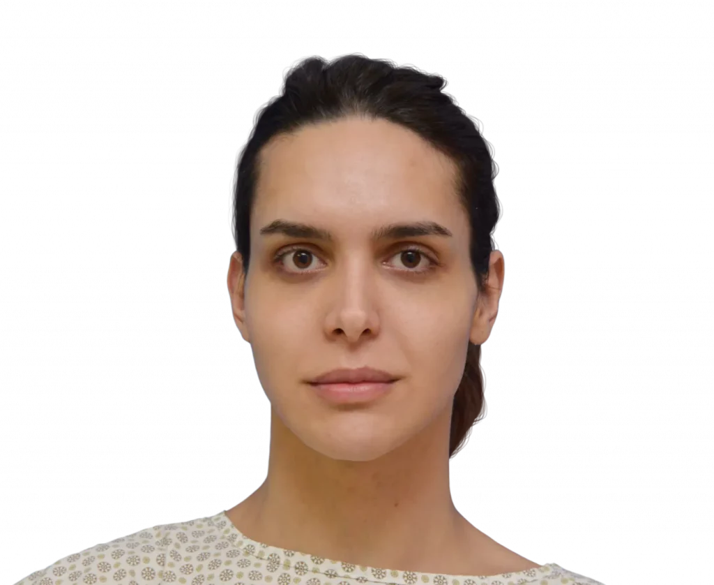 Foto frontal tomada a Viviany antes de la cirugía