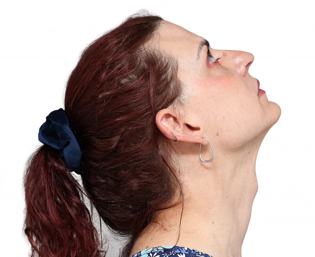 Profilbild von Allison vor der Operation, rechts oben.