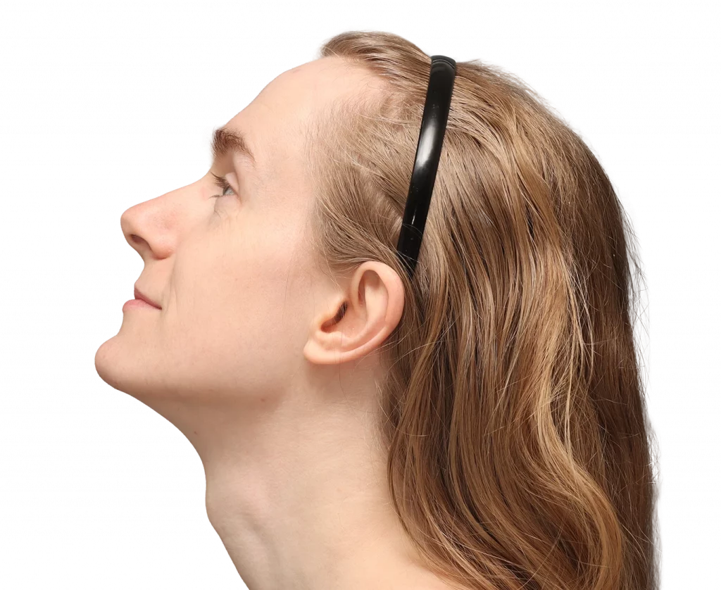 Profilbild von Joanna vor der Operation, rechts oben.